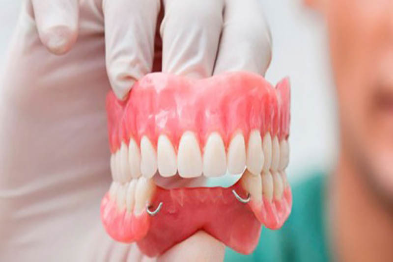 Phục hồi răng mất bằng hàm tháo lắp